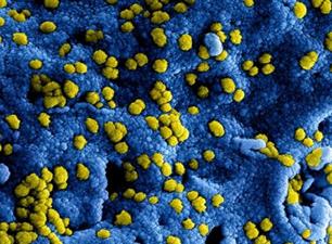 Corona update: alle viswedstrijden mogen weer