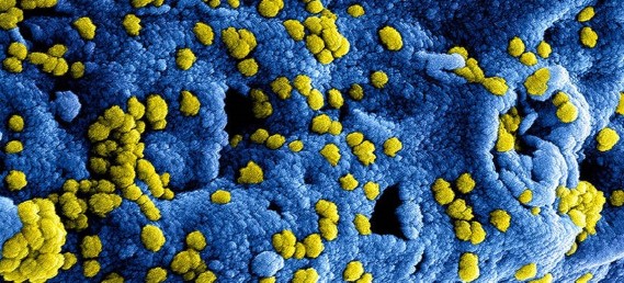 Update coronavirus sportvisserij 7 mei